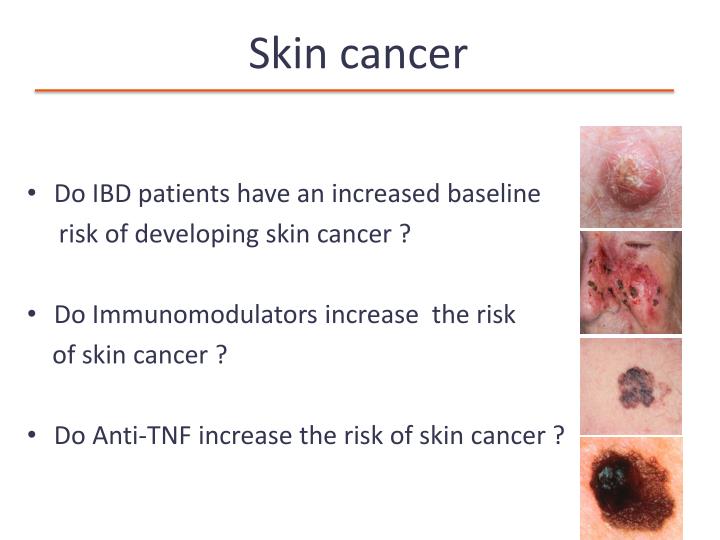 Imuran Side Effects Skin Cancer