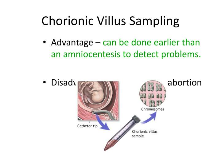 chorionic-villus-sampling-cvs-babycentre