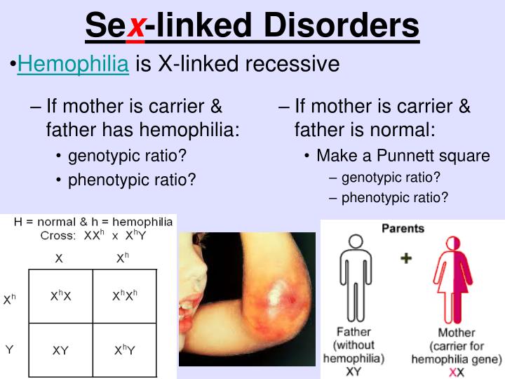 non sex linked 21 non sex linked 21