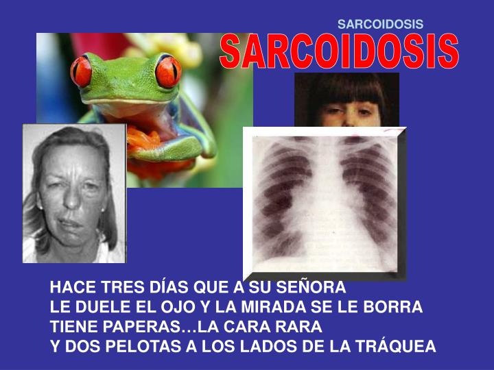 El dolor en la espalda y en el borde izquierdo