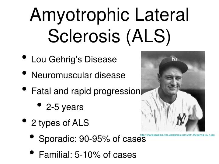 the fatal disease amyotrophic lateral sclerosis essay Only a handful of people know this about me, but five years ago my father died of amyotrophic lateral sclerosis or als this is a fatal disease that literally eats. the fatal disease amyotrophic lateral sclerosis essay Only a handful of people know this about me, but five years ago my father died of amyotrophic lateral sclerosis or als this is a fatal disease that literally eats.