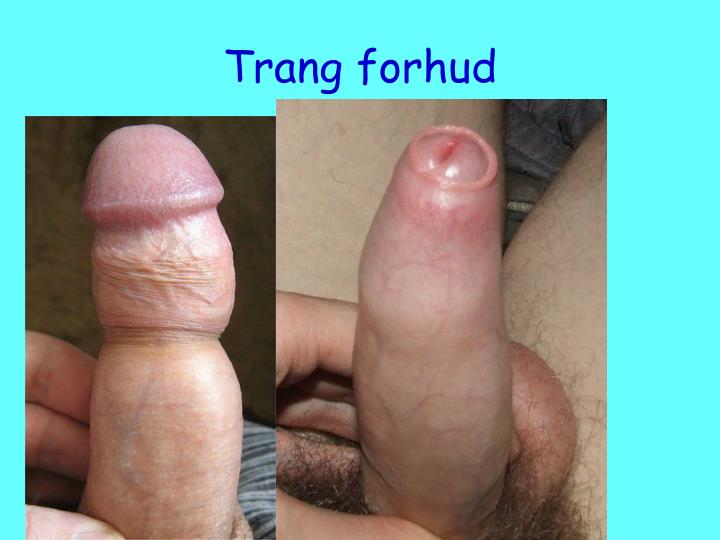 gjennomsnitts penis tromso escort gjennomsnitts penis tromso escort