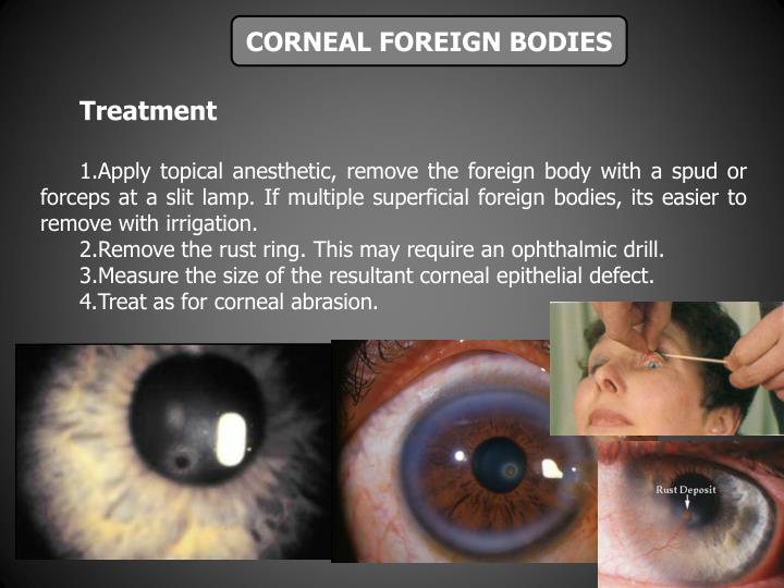 PPT - OCULAR TRAUMA. DIAGNOSIS AND TREATMENT. PowerPoint Presentation ...