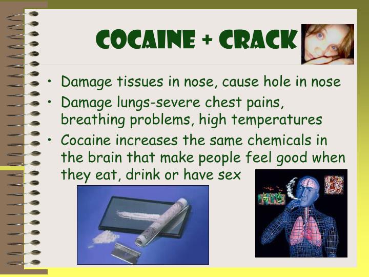 zolpidem overdose and brain damage zolpidem overdose and brain damage