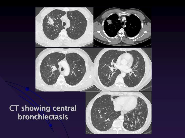 abpa chest ct radiology