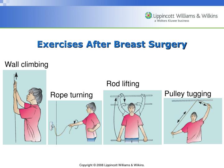 Speaking, opinion, exercises for breast cancer patients Exercises for breast cancer patients sorry, not