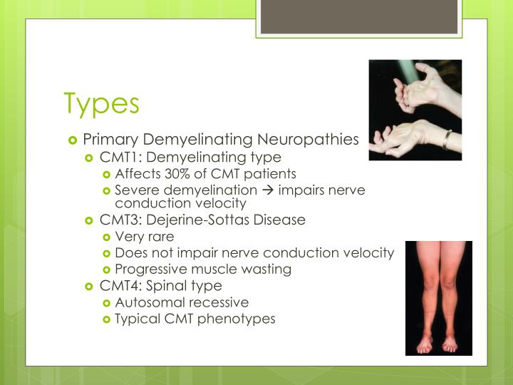 how does myelination affect nerve conduction velocity Human nerve conduction note: that affects the nervous system by damaging myelin sheaths, or destroying membranes and membrane transport, or constricting nerves can be indicated by changes in nerve conduction velocity (ncv) of the patient. how does myelination affect nerve conduction velocity Human nerve conduction note: that affects the nervous system by damaging myelin sheaths, or destroying membranes and membrane transport, or constricting nerves can be indicated by changes in nerve conduction velocity (ncv) of the patient.