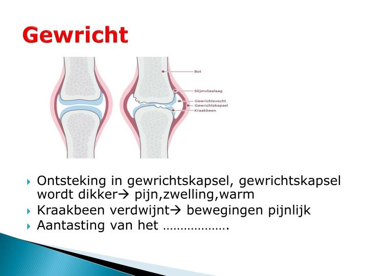 ontsteking bloedvaten symptomen