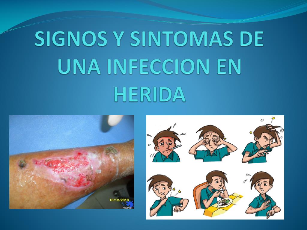 PPT SIGNOS Y SINTOMAS DE UNA INFECCION EN HERIDA PowerPoint