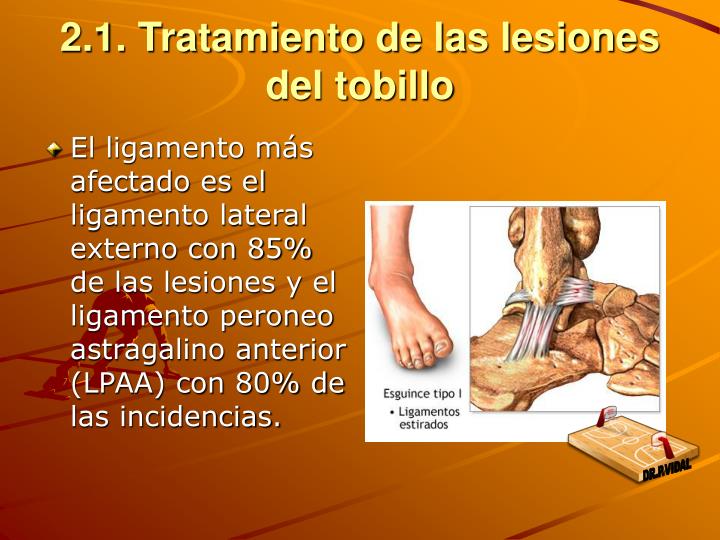 Las pastillas sobre el hongo de los pies