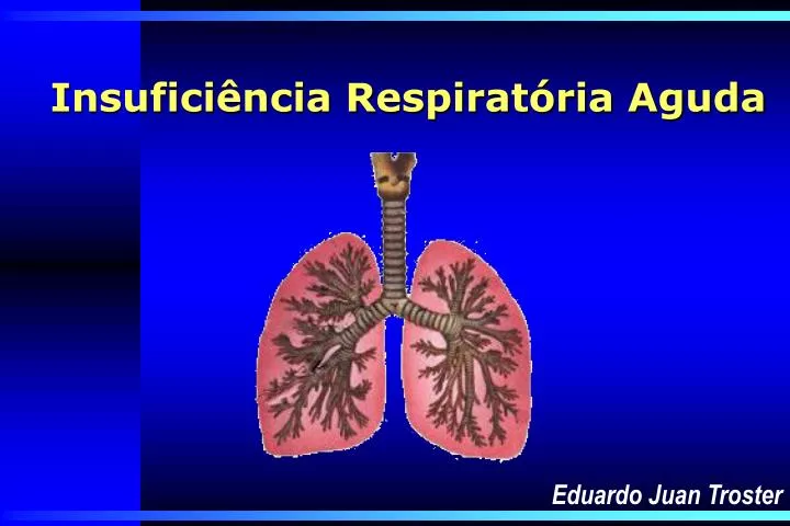 PPT Insuficiência Respiratória Aguda PowerPoint Presentation free