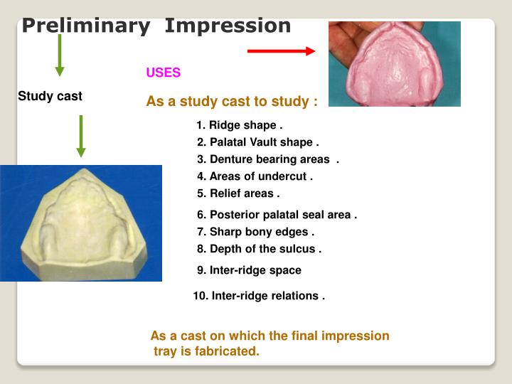PPT Impression tray and impression technique PowerPoint Presentation ID4292535