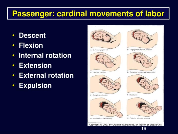 cardinal movements of labor and delivery