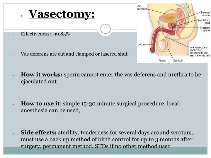 vasectomy presentation This guidance covers pre-operative evaluation and consultation of prospective vasectomy patients techniques for local anesthesia the type of information and information presentation that is most effective to gain the patient's attention. vasectomy presentation This guidance covers pre-operative evaluation and consultation of prospective vasectomy patients techniques for local anesthesia the type of information and information presentation that is most effective to gain the patient's attention.