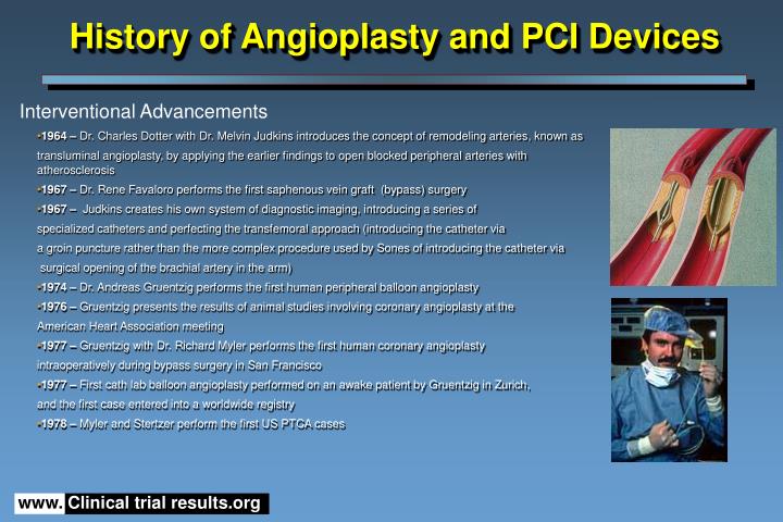 history of angioplasty icd 10