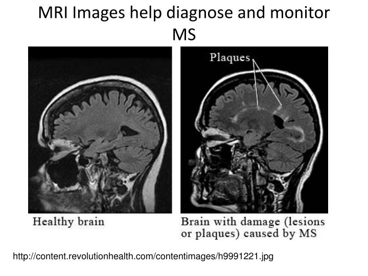 Diagnose Ms Diagnose Ms
