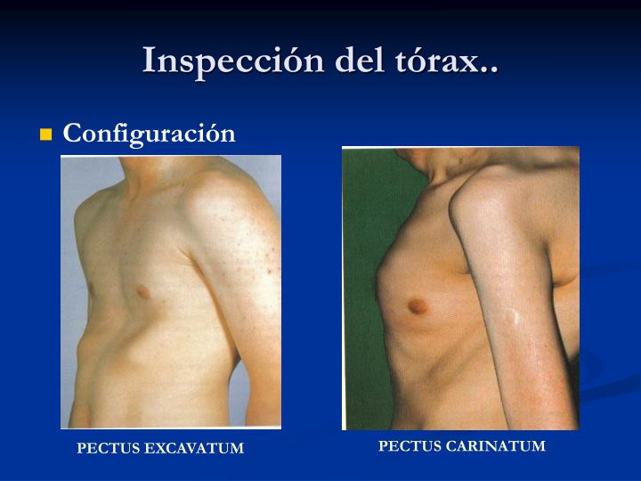 El cáncer de mama de 4 grados la operación