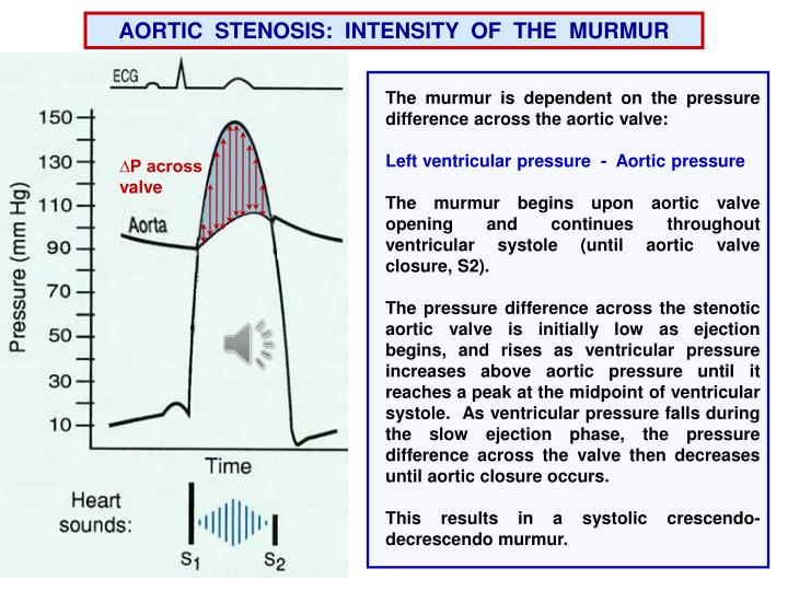 PPT Valve Defects /Cardiac Cycle PowerPoint Presentation