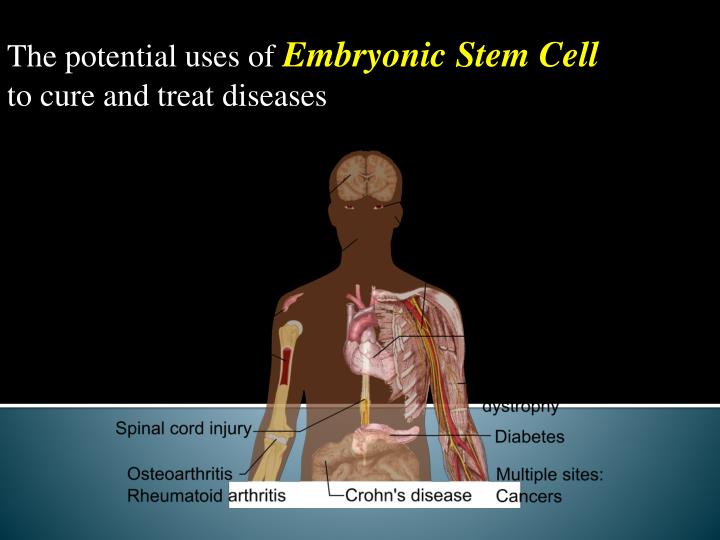 somatic stem cells definition somatic stem cells definition