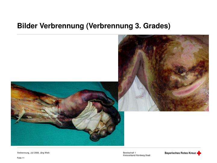 PPT Verbrennung PowerPoint Presentation ID4980093