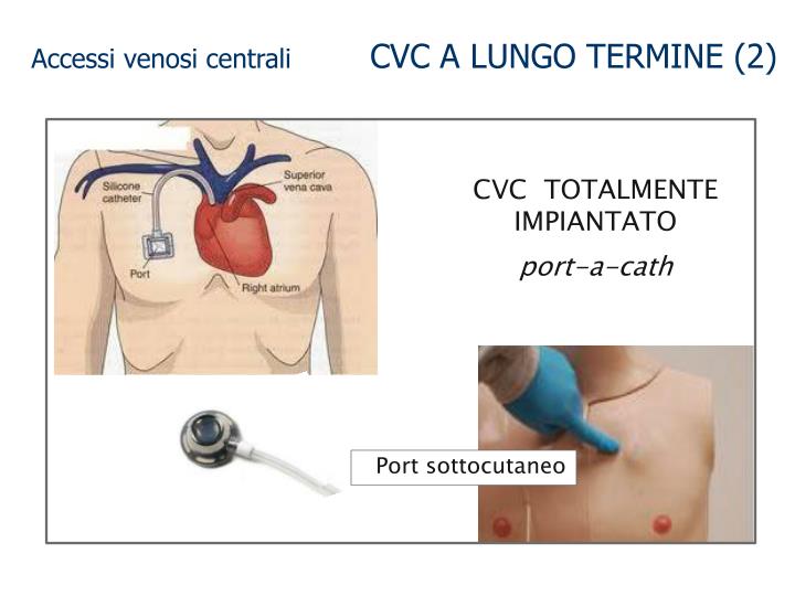 Trombosi di vene profonde a diabete