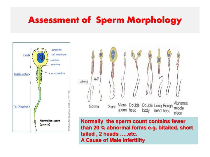 This awesome! causes of poor sperm morphology