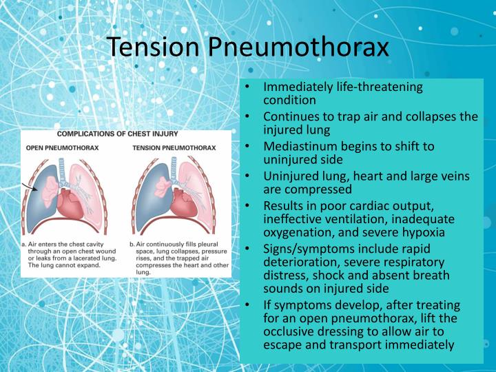 PPT Chest Trauma PowerPoint Presentation ID5319182