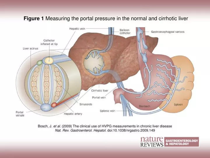 How To Check Portal Pressure