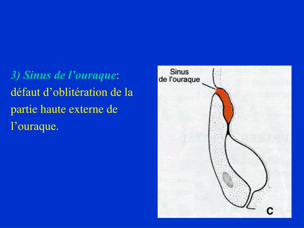 PPT MALFORMATIONS UROGENITALES PowerPoint Presentation Free Download PPT MALFORMATIONS UROGENITALES PowerPoint Presentation Free Download