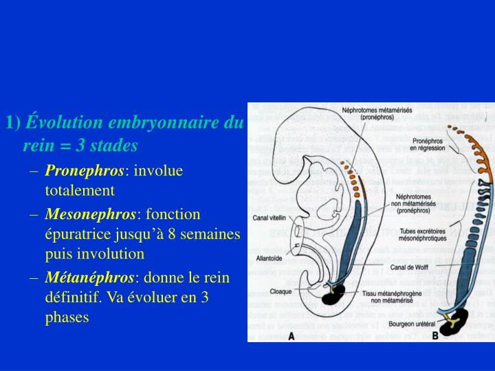 Evolution De La Maladie De Cacchi Ricci