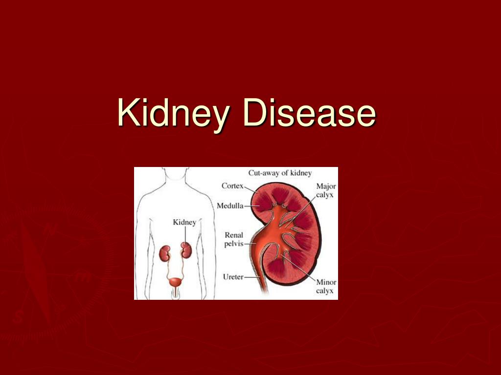 kidney disease presentation