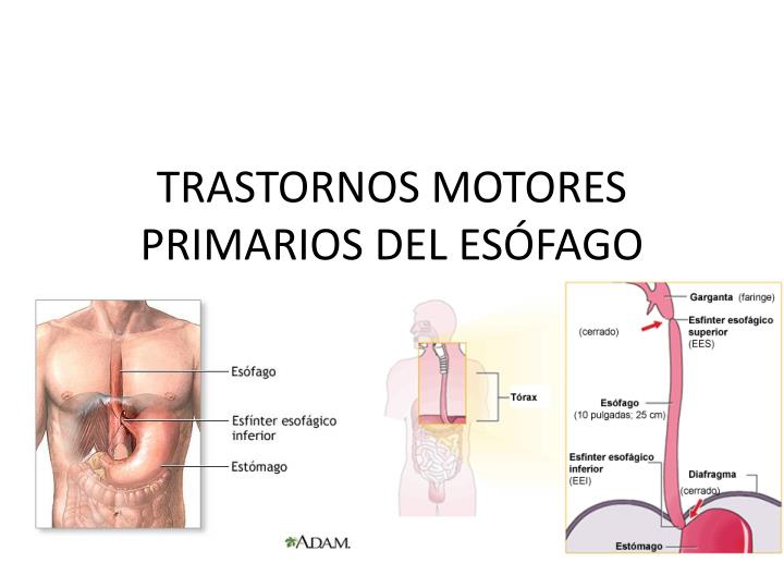 trastornos motores del esofago