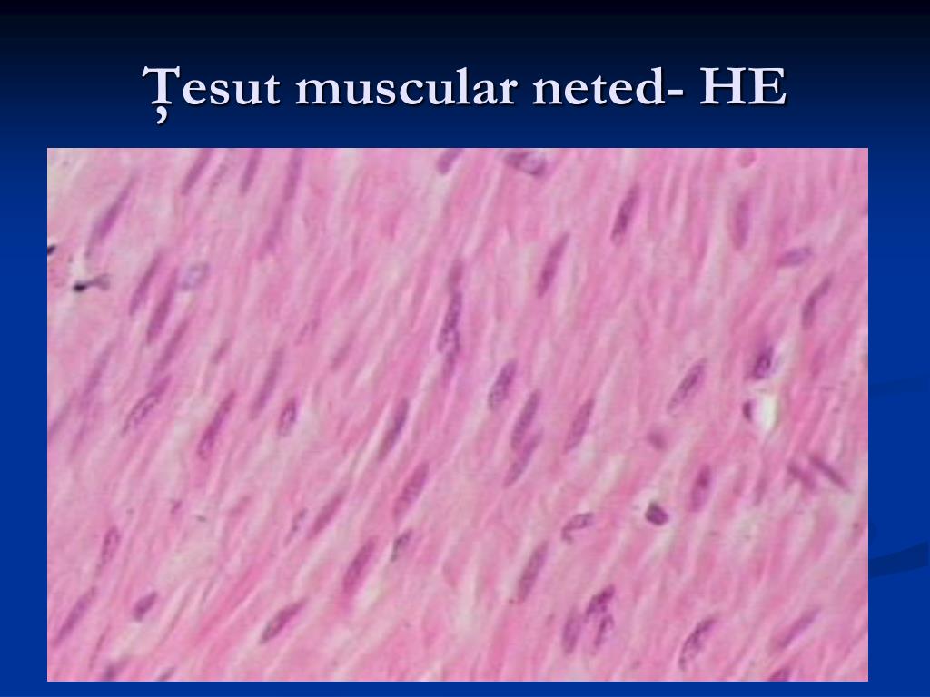 PPT - ŢESUTUL MUSCULAR NETED PowerPoint Presentation, free download -  ID:3653918