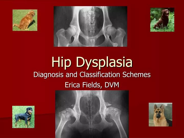 PPT Hip Dysplasia PowerPoint Presentation, free download ID3654141