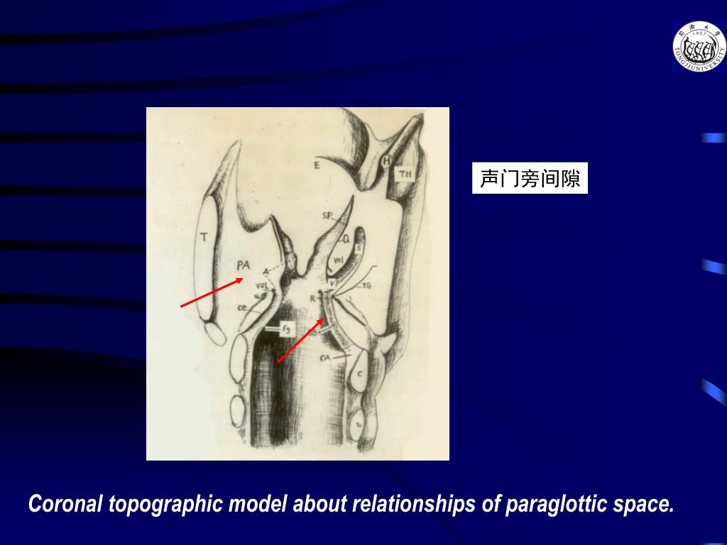 PPT - 贯声门癌组织病理学研究和临床 Histopathological Research of Transglottic ...