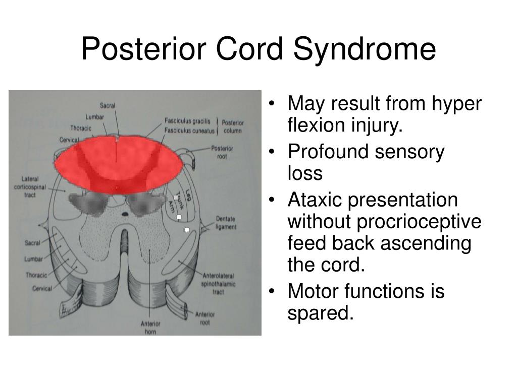PPT - Clinical Considerations of the Nervous System ...