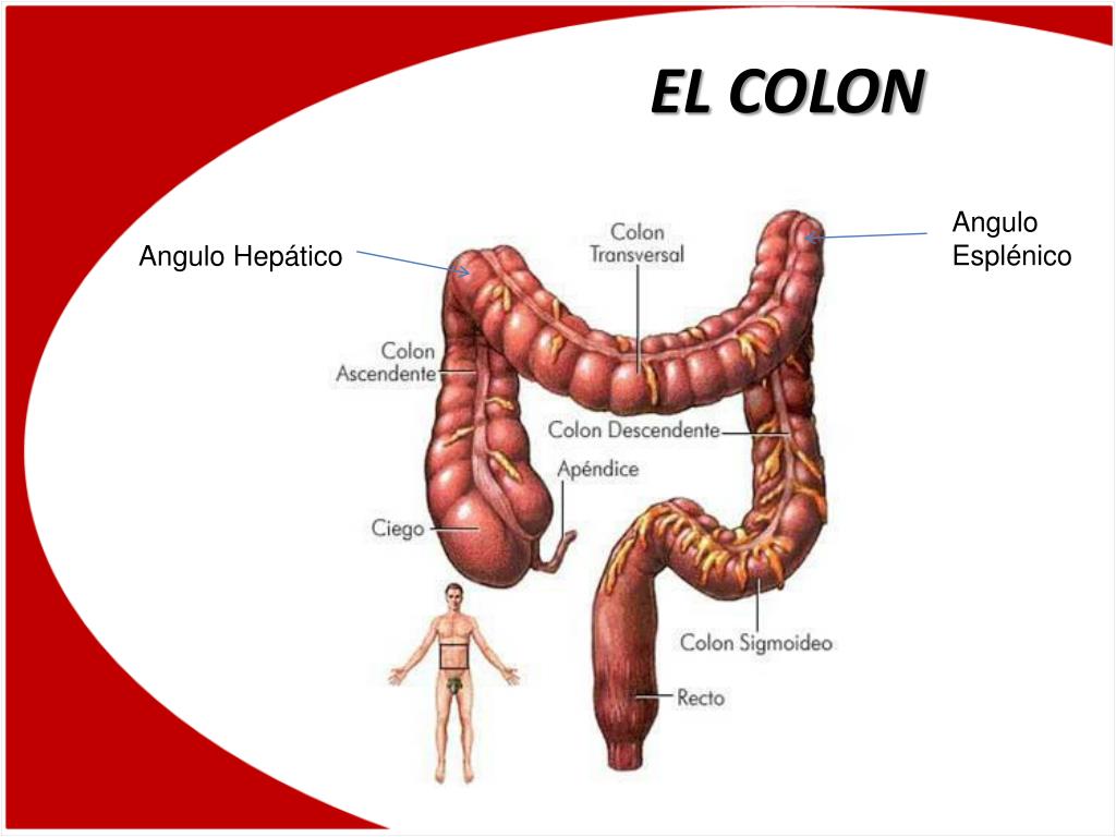 Colon / rectal cancer - meddic