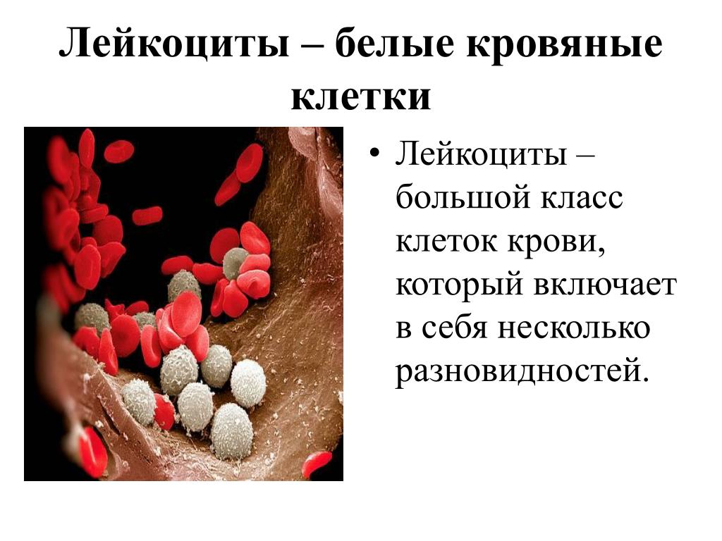 Почему низкие лейкоциты в крови. Клетки лейкоцитов. Заболевания связанные с лейкоцитами. Белые кровяные клетки больше. Лейкоциты в крови у ребенка.