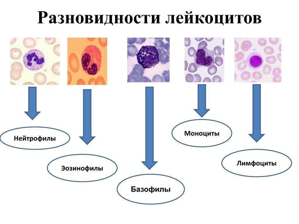 Как обозначаются лимфоциты в крови. Разновидности лейкоцитов базофилы. Строение разных видов лейкоцитов. Основные формы лейкоцитов рисунок. Лейкоцитарная формула функции лейкоцитов таблица.