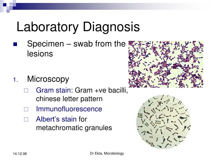 PPT - Corynebacteria PowerPoint Presentation - ID:3672797