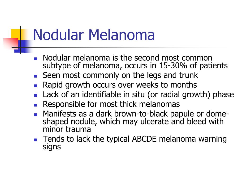 PPT Surgical Treatment of Malignant Melanoma PowerPoint Presentation