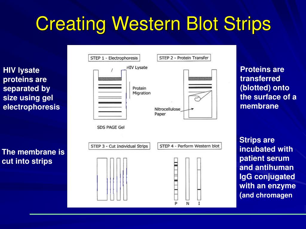 positive elisa negative western blot positive elisa negative western blot