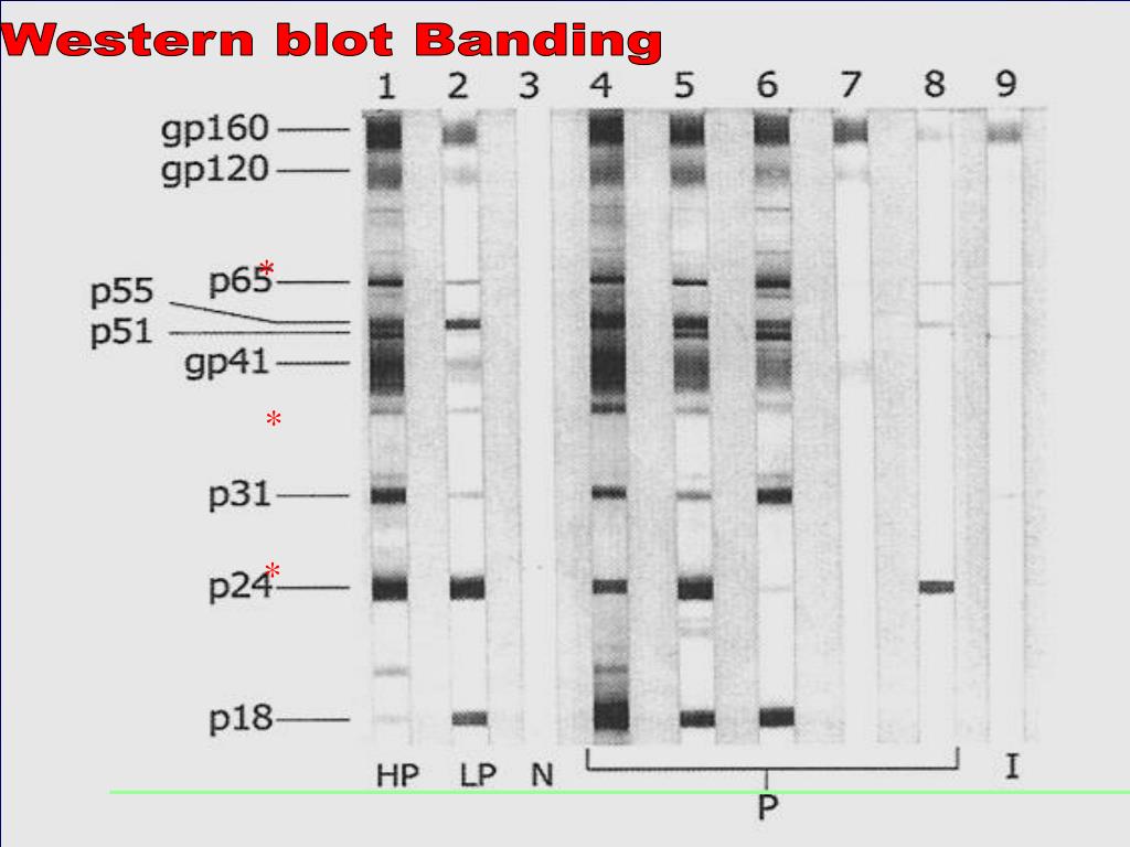 western blot test and elisa test western blot test and elisa test