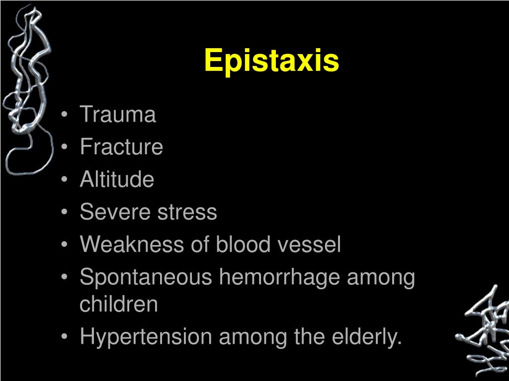 sinus barotrauma sinus barotrauma
