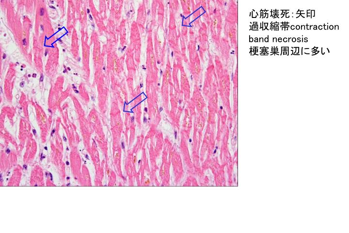 ベルト 名称 | フランクミュラー ベルト 通贩