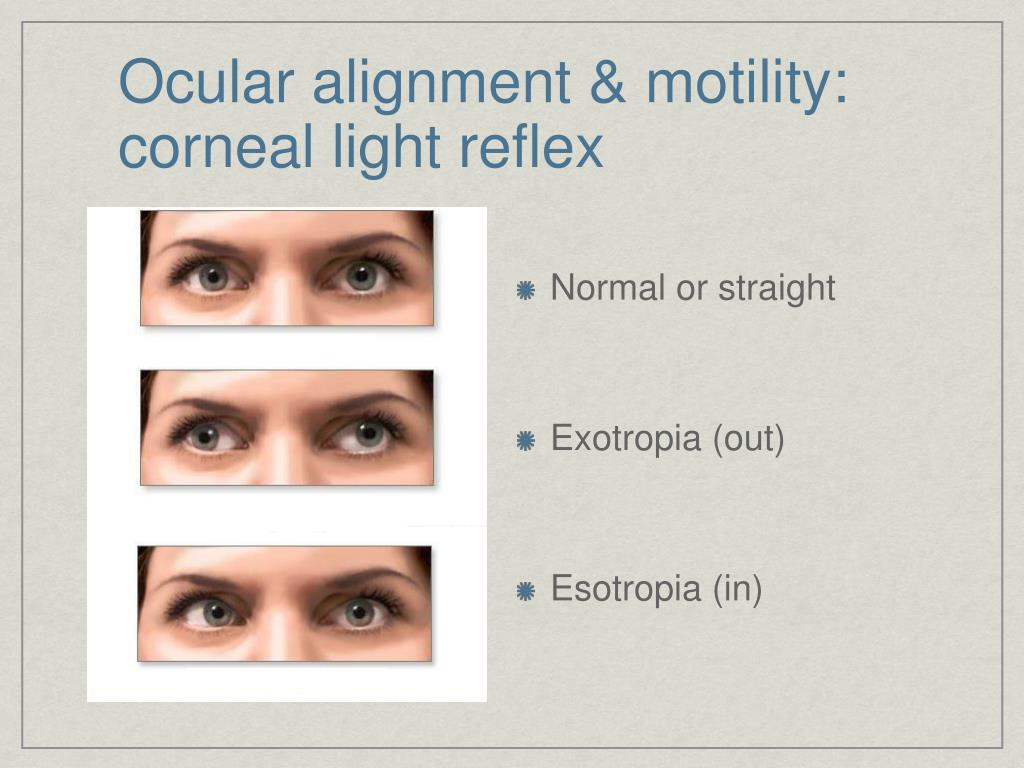 PPT The Basic Eye Examination PowerPoint Presentation, free download PPT The Basic Eye Examination PowerPoint Presentation, free download