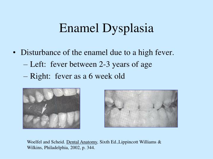 PPT Dental Anomalies PowerPoint Presentation ID3700780