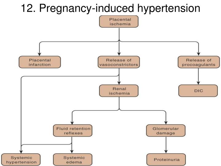 pregnancy induced hypertension Take a 300 mg per day of this essential mineral to help prevent gestational other methods that can ease the stress that contributes to gestational hypertension. pregnancy induced hypertension Take a 300 mg per day of this essential mineral to help prevent gestational other methods that can ease the stress that contributes to gestational hypertension.