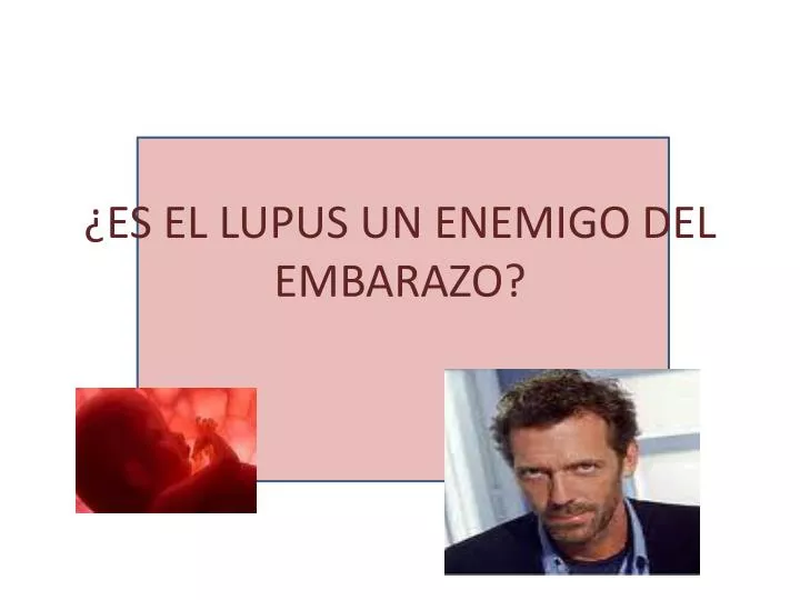 Ppt 191 Es El Lupus Un Enemigo Del Embarazo Powerpoint Presentation Id 3707035 Sle Business Presentation