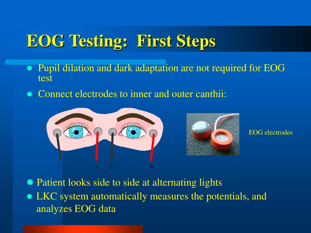 PPT Functional Testing of the Eye Clinical Electrophysiology of